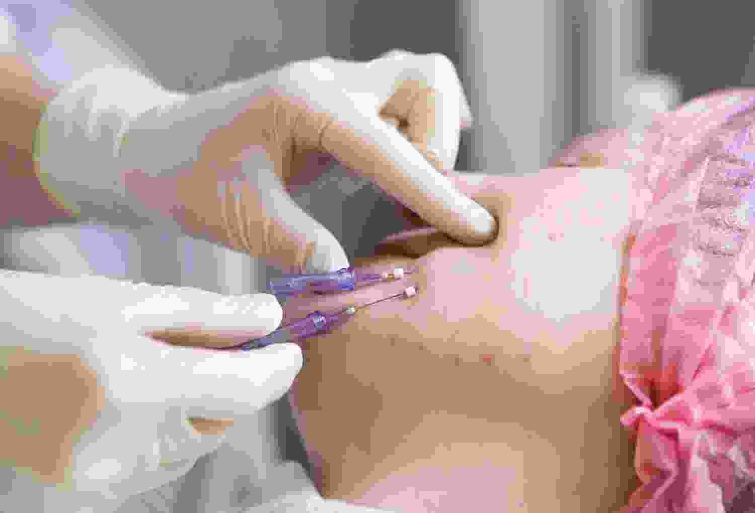 Chin Surgery For a Refreshed Look 1 blog listing 10