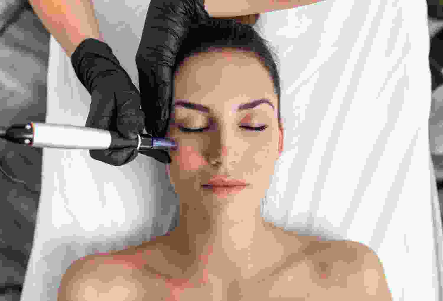 Laser Facial Treatment Laser Facial Treatment