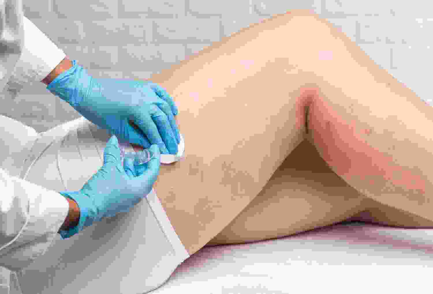 How Recovery Appears Post-Op 2 blog listing 03