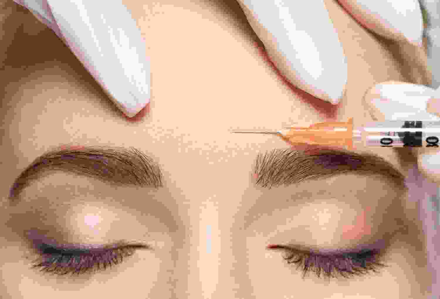 Wrinkle Treatment Wrinkle Treatment