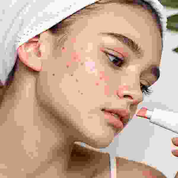 Spot Treatment Gels Categorey Image